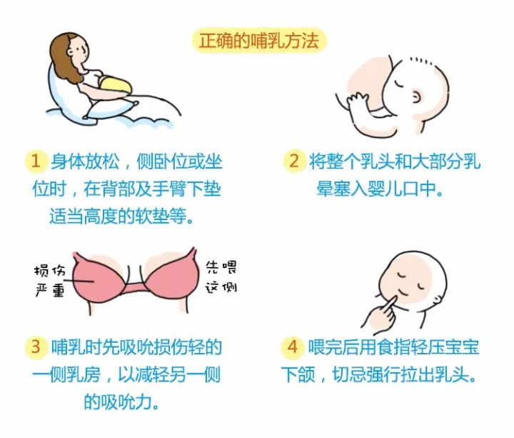 孕妇五个月乳头流水的原因与应对方法